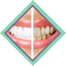 Periodoncia